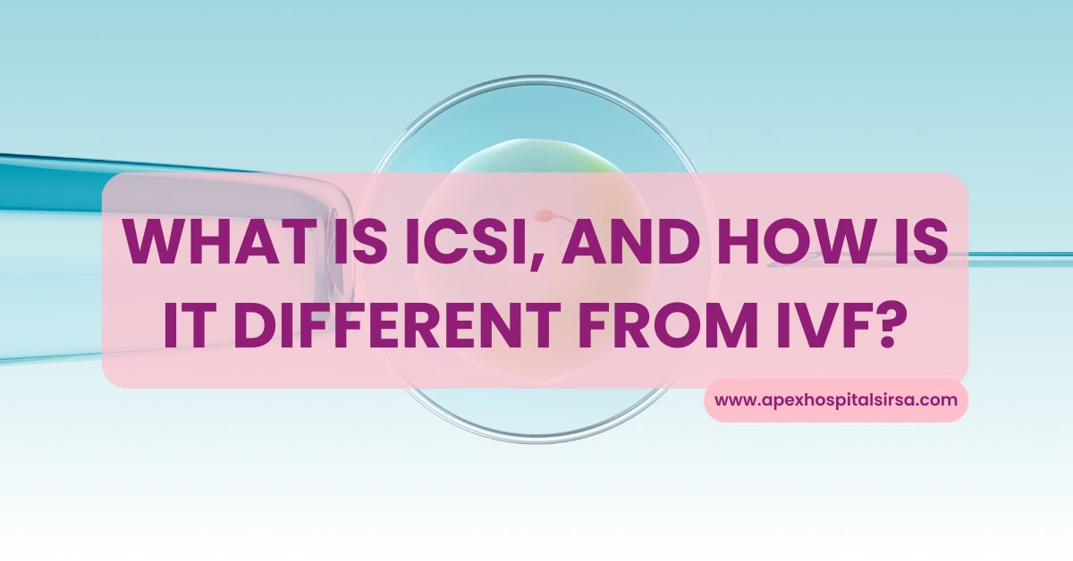 what is icsi