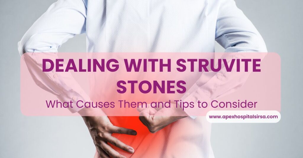 struvite stones