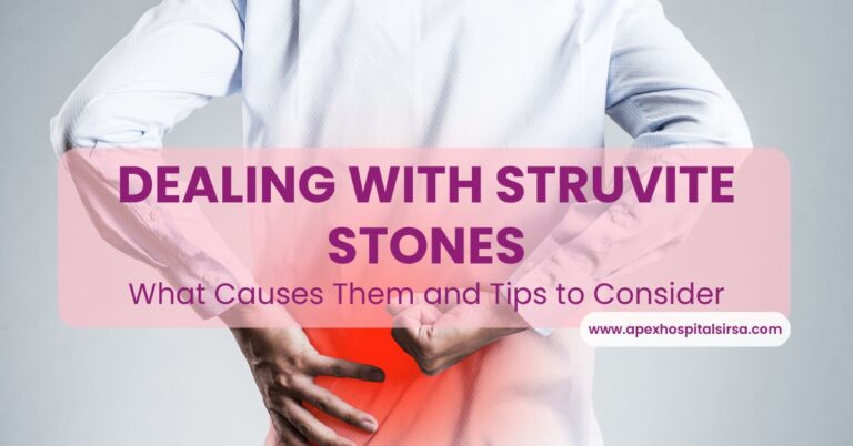 struvite stones