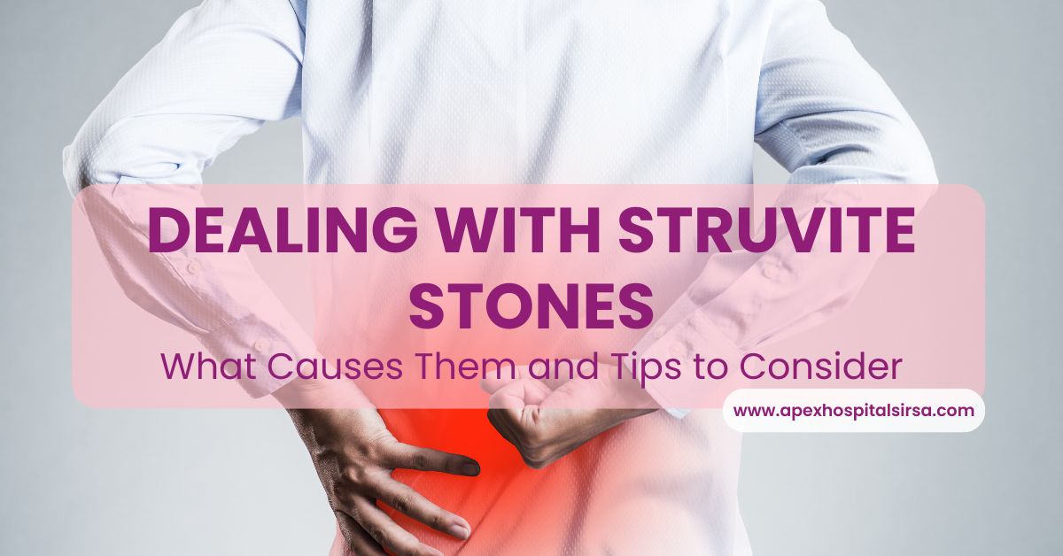struvite stones