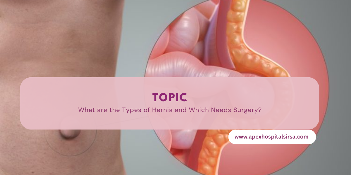 What are the Types of Hernia and Which Needs Surgery