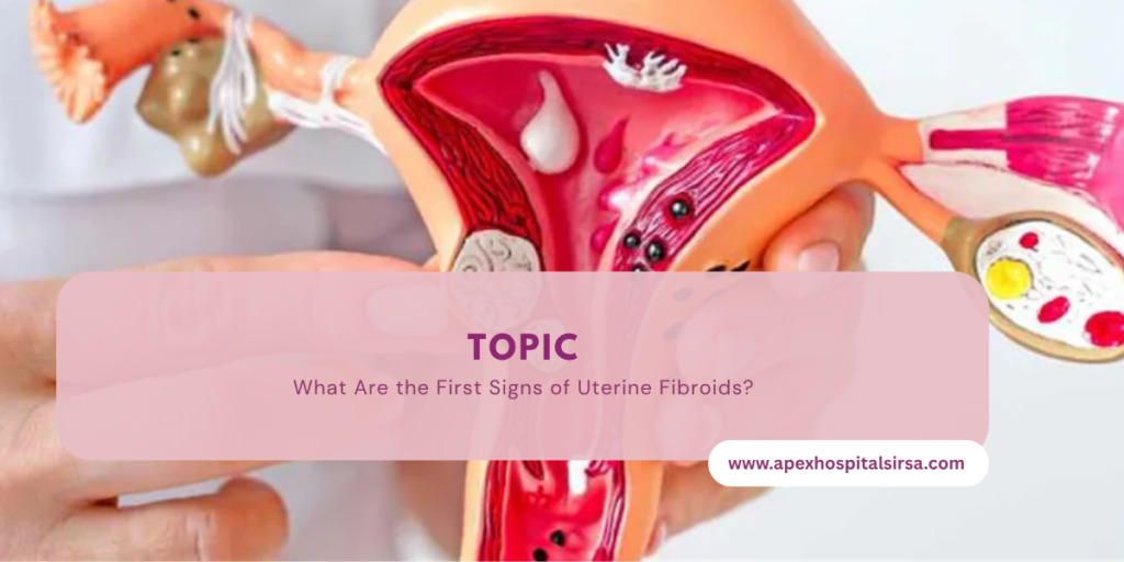 What Are the First Signs of Uterine Fibroids