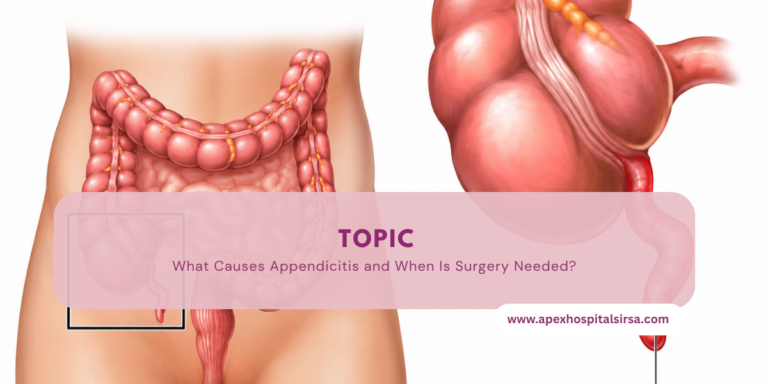 What Causes Appendicitis and When Is Surgery Needed