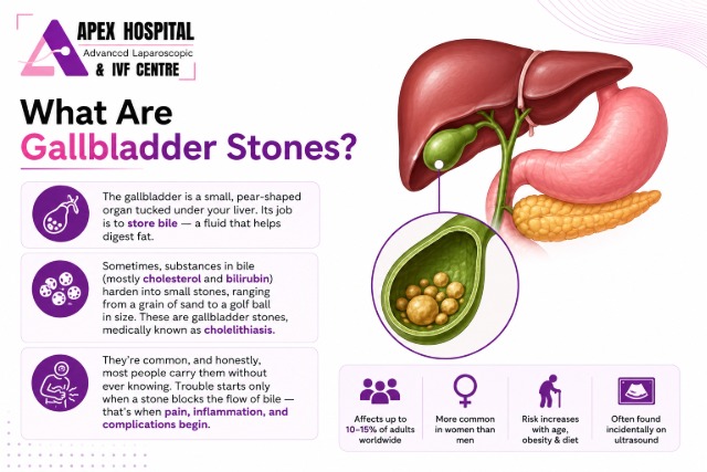 gallbladder stone symptoms